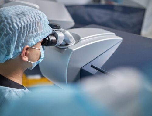 chirurgie laser yeux