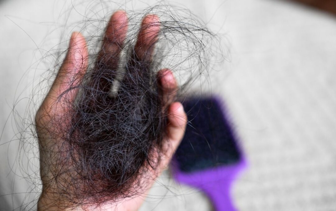 femme perte cheveux