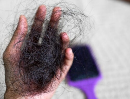 femme perte cheveux