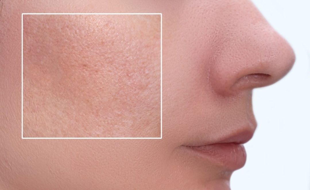 pore de la peau femme
