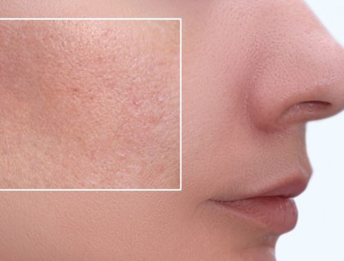 pore de la peau femme